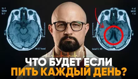 КАК ВЫГЛЯДИТ СМЕРТЬ ОТ АЛКОГОЛЯ?
