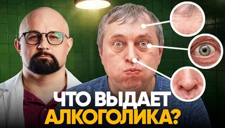 КАК РАСПОЗНАТЬ АЛКОГОЛИКА С ПЕРВОГО ВЗГЛЯДА?